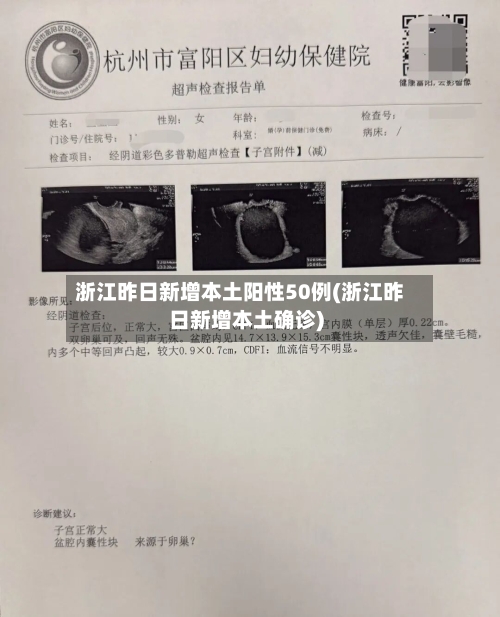 浙江昨日新增本土阳性50例(浙江昨日新增本土确诊)