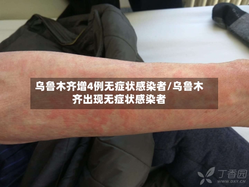 乌鲁木齐增4例无症状感染者/乌鲁木齐出现无症状感染者